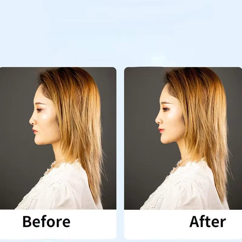 The Stretching Straps for Lift the Eyes and Eyebrows Bb Clip Elastic Band Adjustable Rubber for Hair Anti-Wrinkle Face Tapes